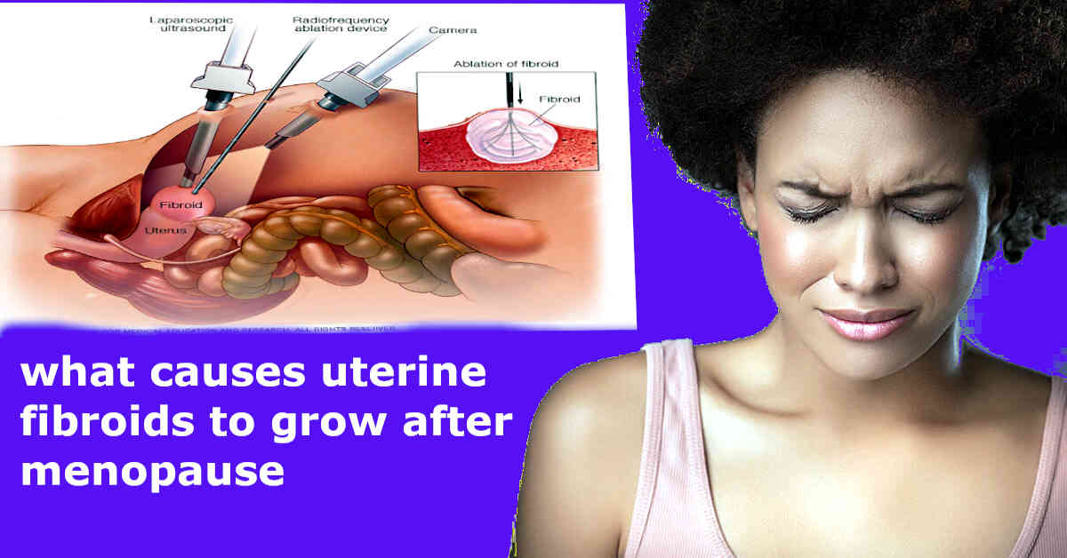 what causes uterine fibroids to grow after menopause